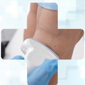 Deep Vein Thrombosis (DVT) Ultrasound Scan